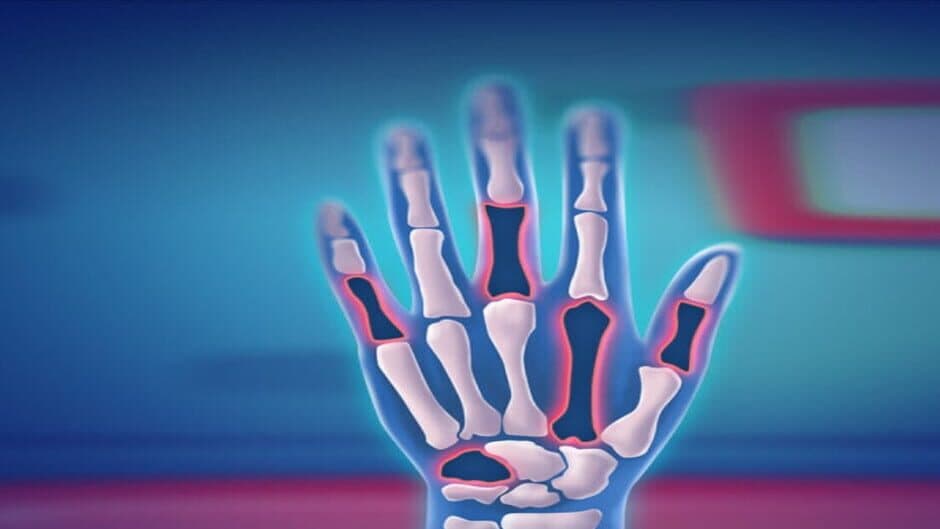 Fix My Hand Doc